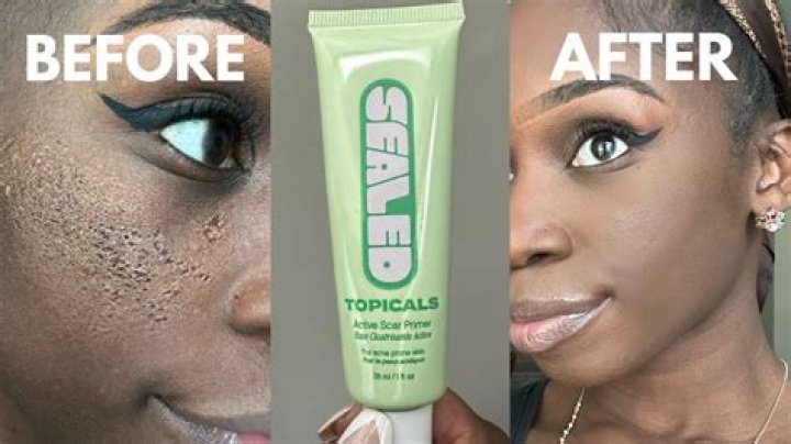 Are indented naturals bad
