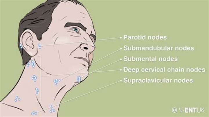 Are there lymph nodes in the Suprasternal notch