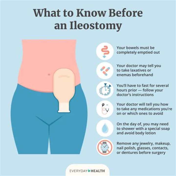 Can you poop when you have an ileostomy
