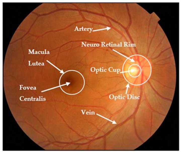 Can you see the macula lutea with an ophthalmoscope