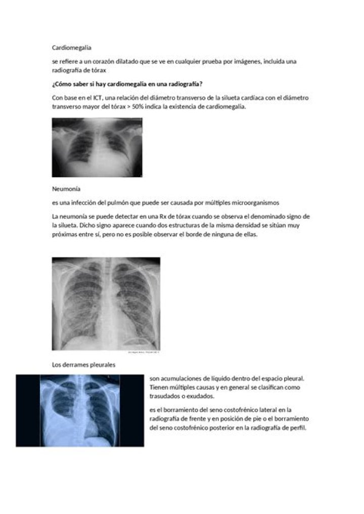 ¿Cuáles son las 5 patologias del torax