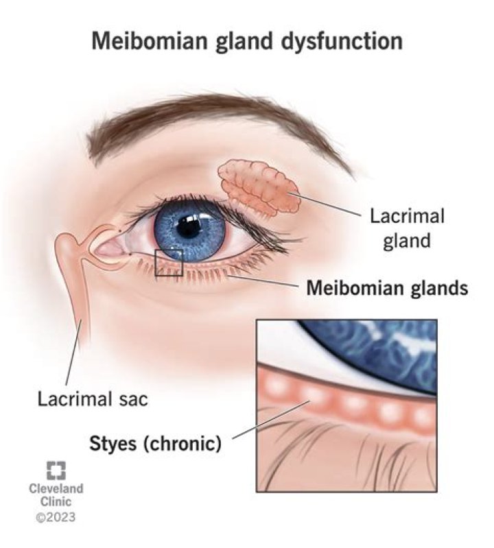 Do eyelids have sweat glands