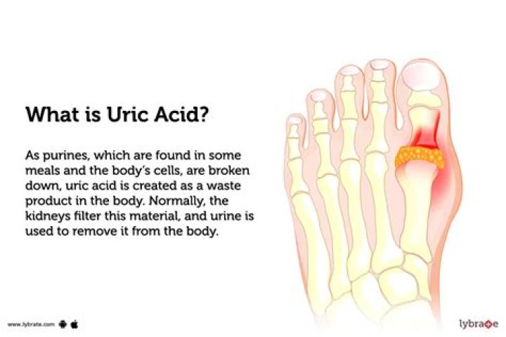 Does aspirin increase uric acid