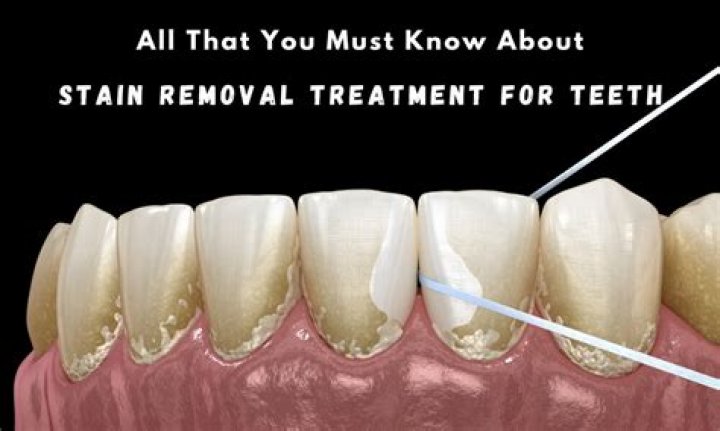 Does Salt remove oil stains