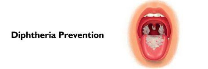 How can you prevent diphtheria