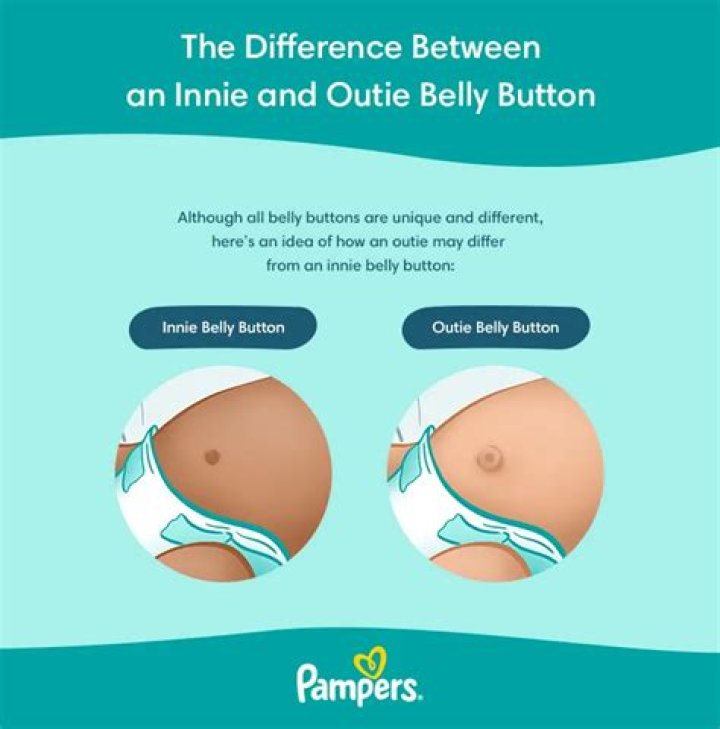 How do I know if my babys belly button is innie or outie