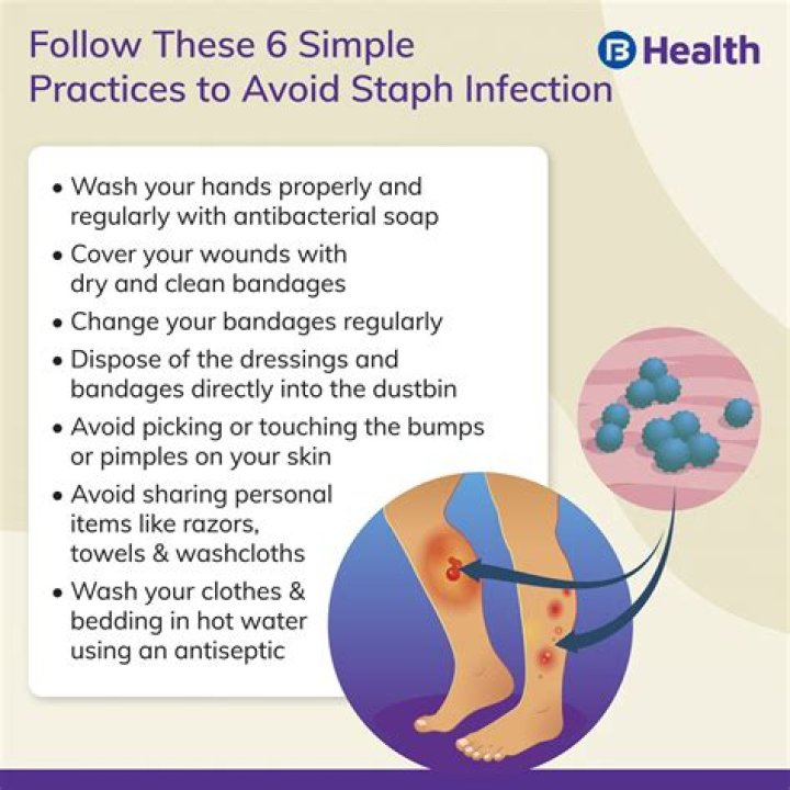 How do you know if you have a staph infection after surgery