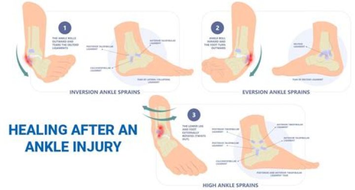 How do you treat a joint injury