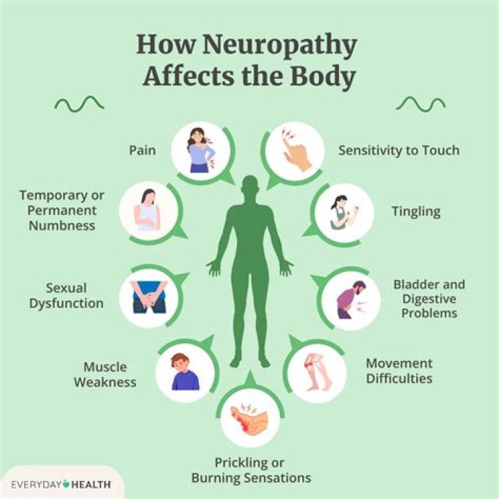 How do you treat neuritis