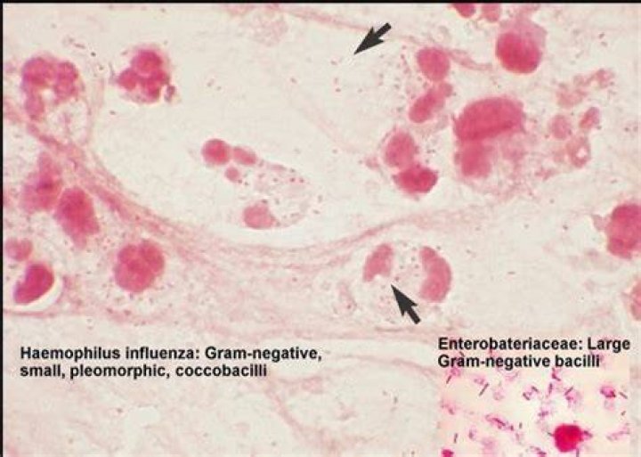 Is Haemophilus Parainfluenzae oxidase positive