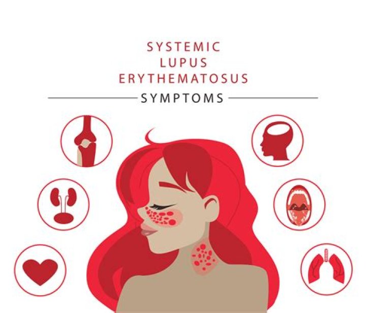 Is Numbness a symptom of lupus
