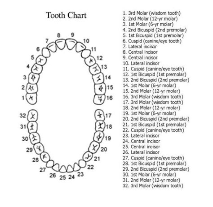Is tooth number 18 a wisdom tooth