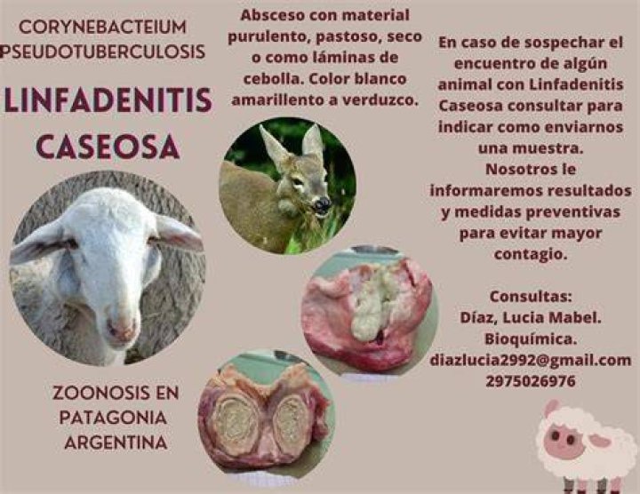 ¿Qué es una linfangitis en la pierna