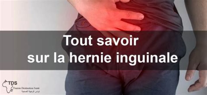 Quest-ce quune hernie au nombril