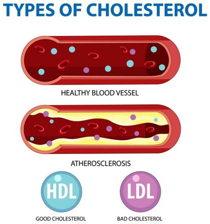 What are HDL and LDL and their functions
