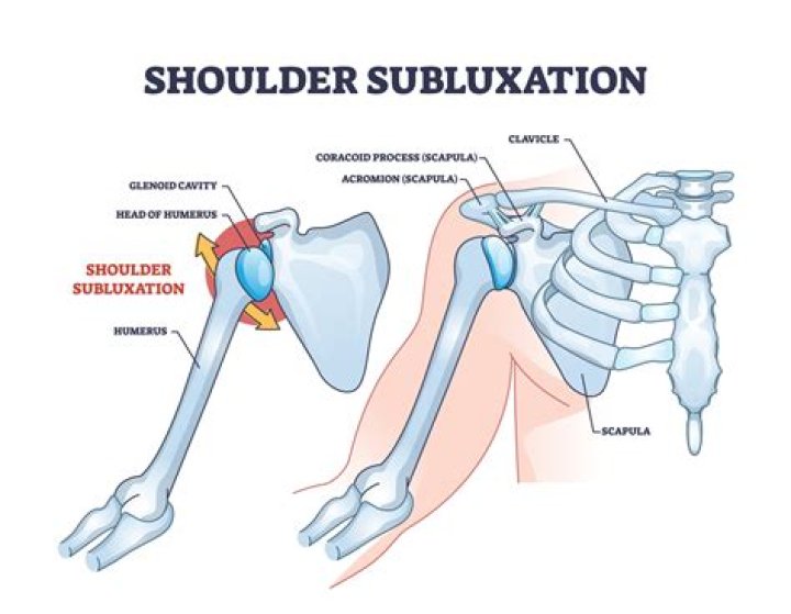 What are some signs that a joint is dislocated or subluxated