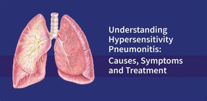 What are the symptoms of hypersensitivity pneumonitis