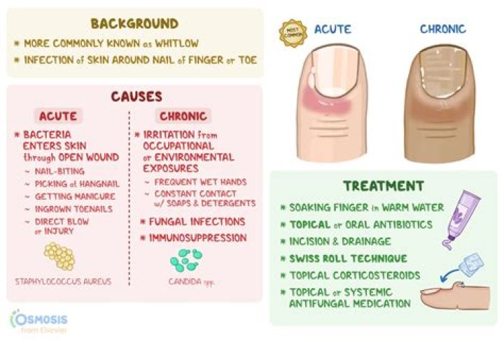 What are the three types of cuticles