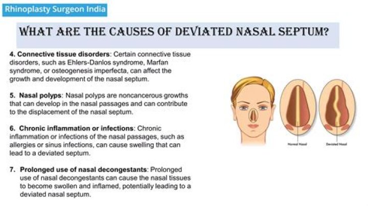 What causes a deviated tongue