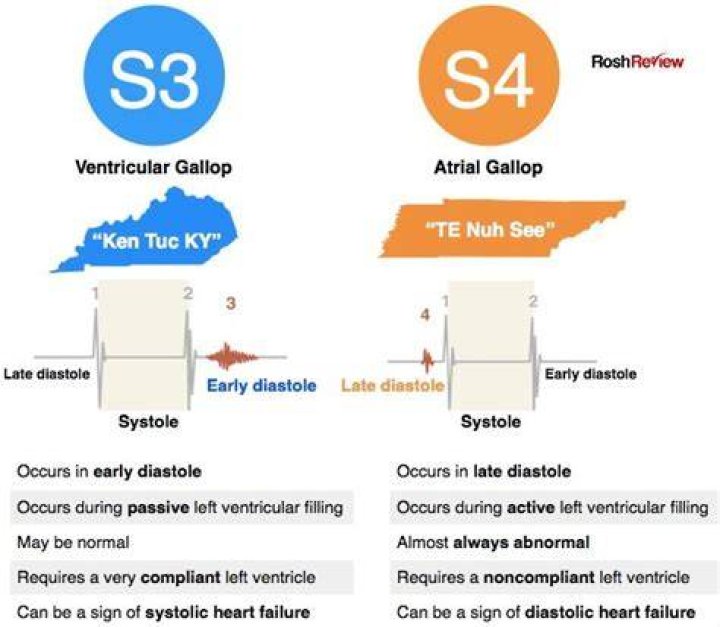 What causes an s4 gallop