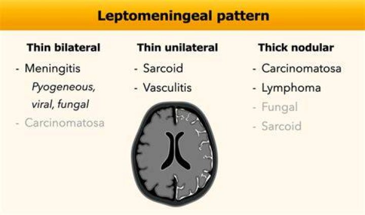 What causes leptomeningeal enhancement