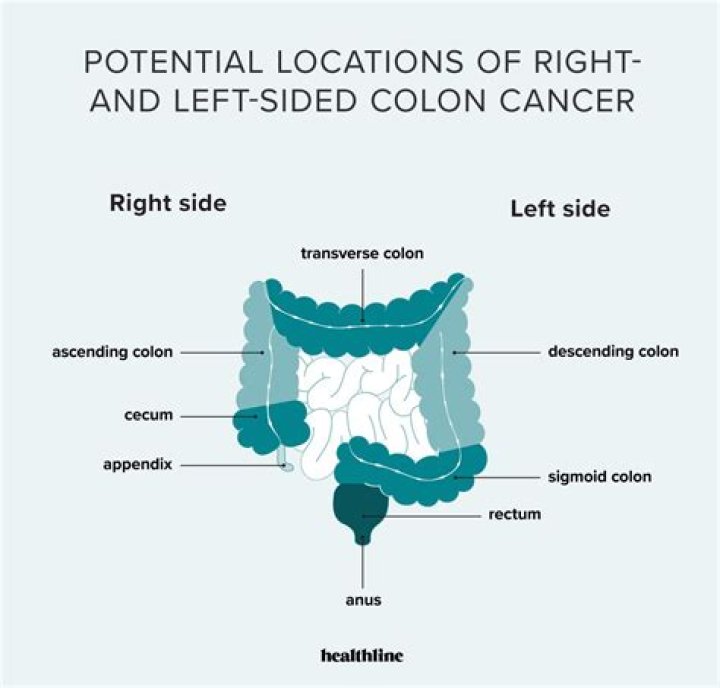What causes right sided colon pain