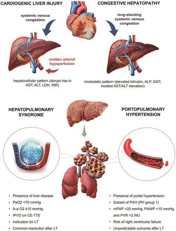 What does the root hepato mean