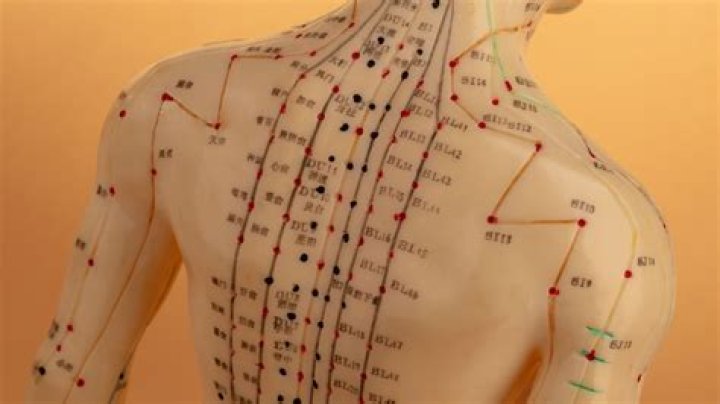 What is acupoint therapy