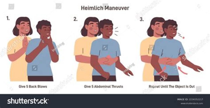 What is another name for the Heimlich maneuver