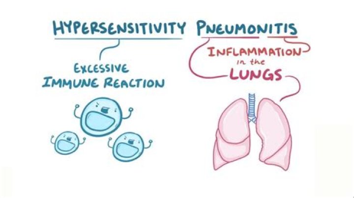 What is hypersensitivity pneumonia