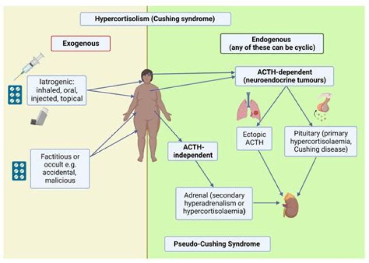 What is iatrogenic hyponatremia
