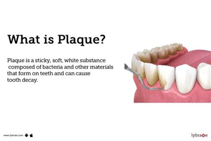 What is plaque formation