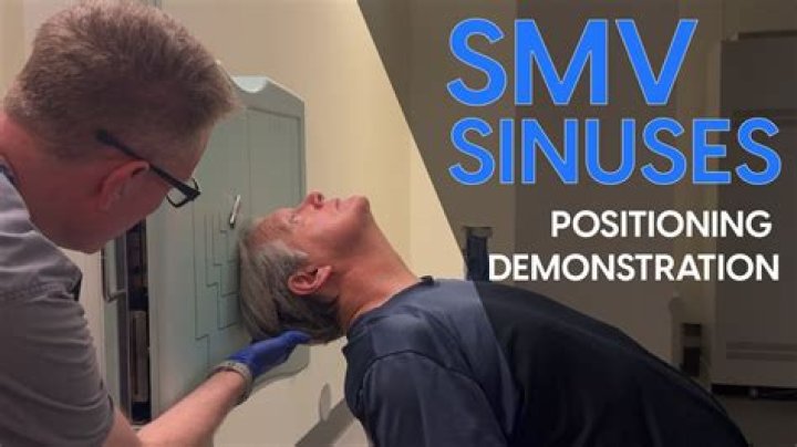 What is SMV medical