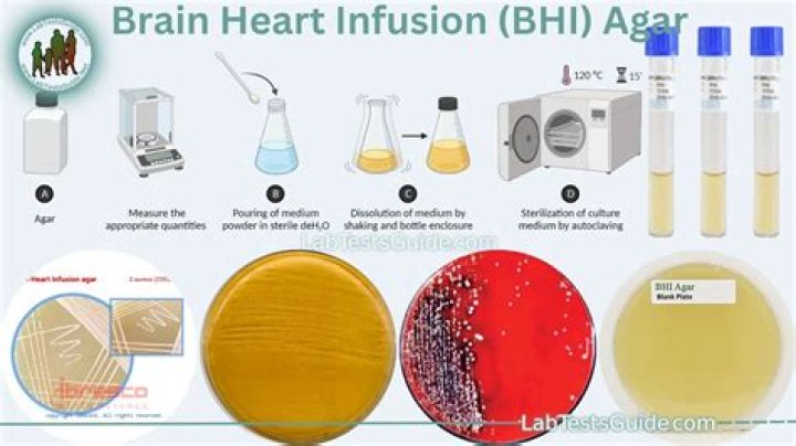 What is the composition of brain heart infusion agar