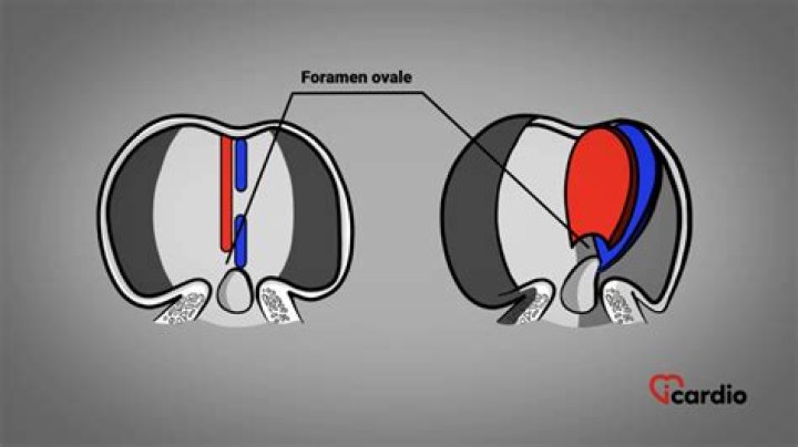 What is the foramen ovale quizlet