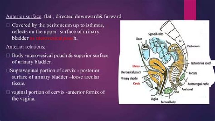 What is the rounded upper portion of the uterus