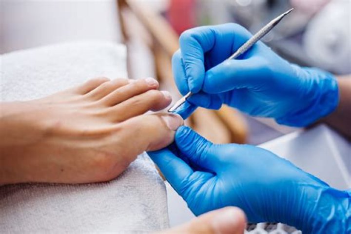 What is the vandenbos procedure