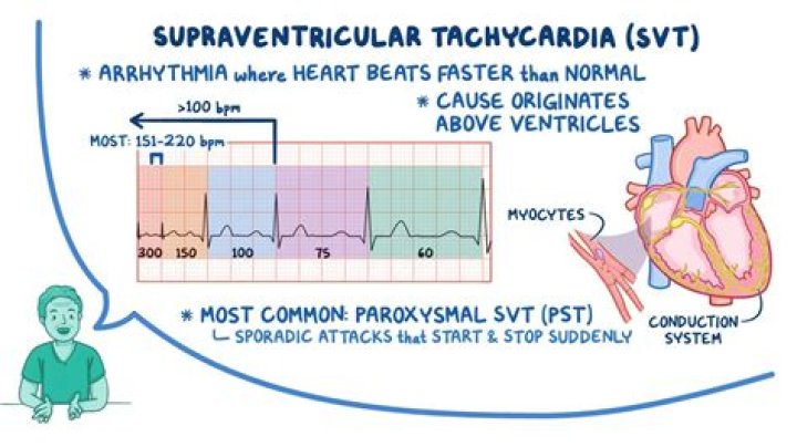 What is the ventricular heart rate with junctional tachycardia