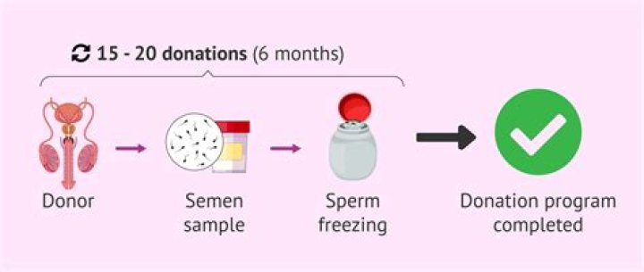 Where can I find a sperm donor