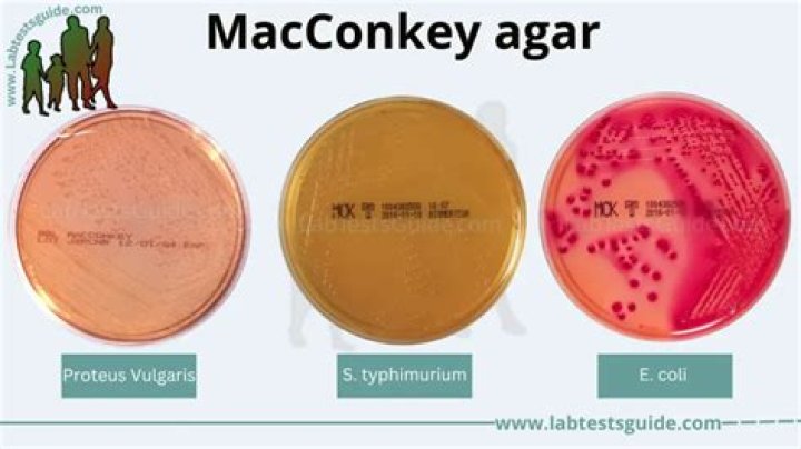 Why is an indicator dye used in MacConkey Agar